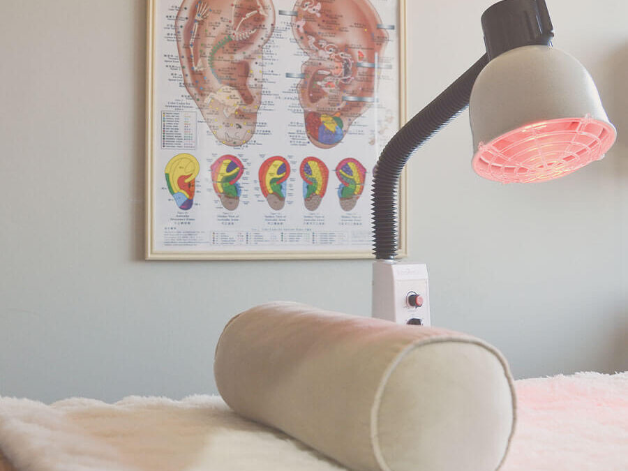 What Can Acupuncture Help With?  A Beginner’s Guide for Castle Rock Patients